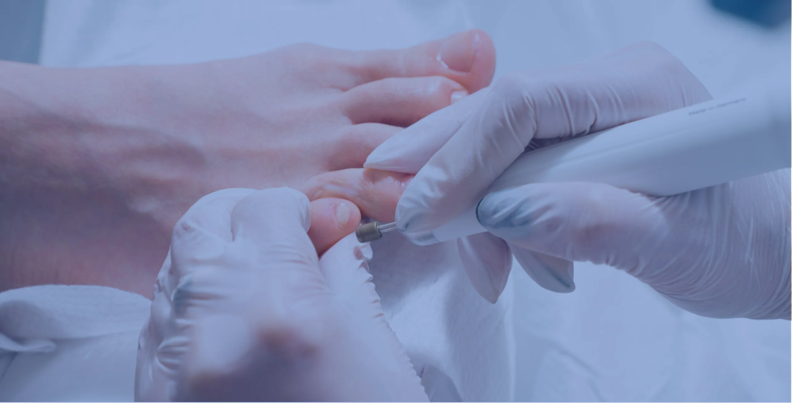 Podiatrist performing a toenail treatment